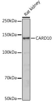 CARD10 Rabbit Polyclonal Antibody - Image 2