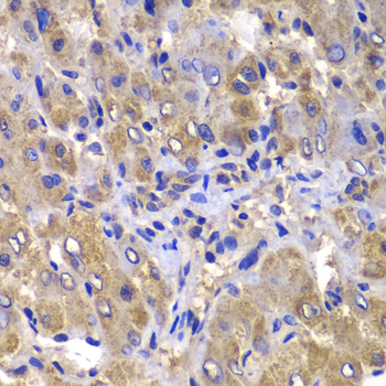 CARD10 Rabbit Polyclonal Antibody - Image 3