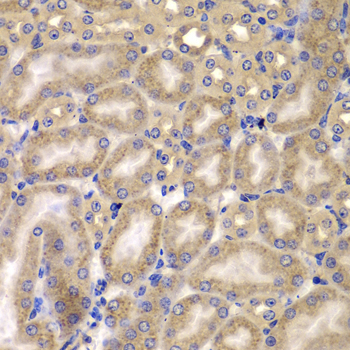 CARD10 Rabbit Polyclonal Antibody - Image 4