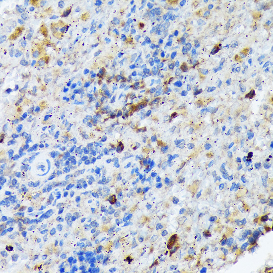 CARD11 Rabbit Monoclonal Antibody - Image 2