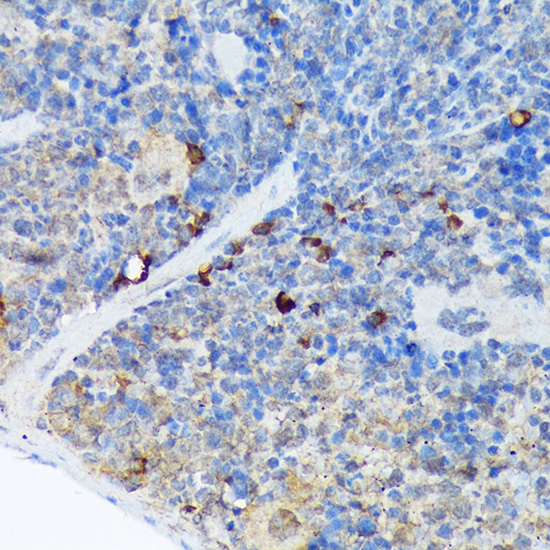 CARD11 Rabbit Monoclonal Antibody - Image 3