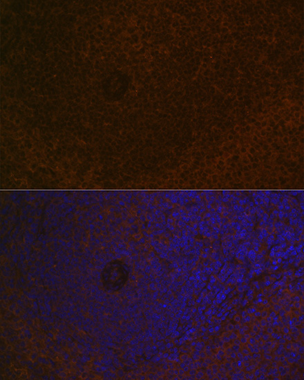 CARD11 Rabbit Monoclonal Antibody - Image 4
