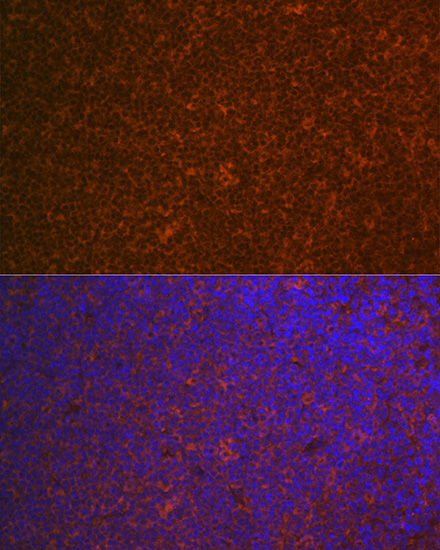 CARD11 Rabbit Monoclonal Antibody - Image 5