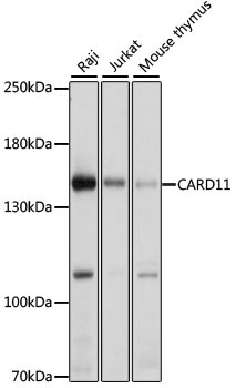 CARD11 Rabbit Polyclonal Antibody