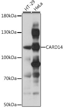 CARD14 Rabbit Polyclonal Antibody