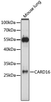 CARD16 Rabbit Polyclonal Antibody