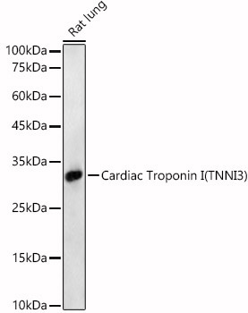 Cardiac Troponin I (TNNI3) Rabbit Polyclonal Antibody - Image 2