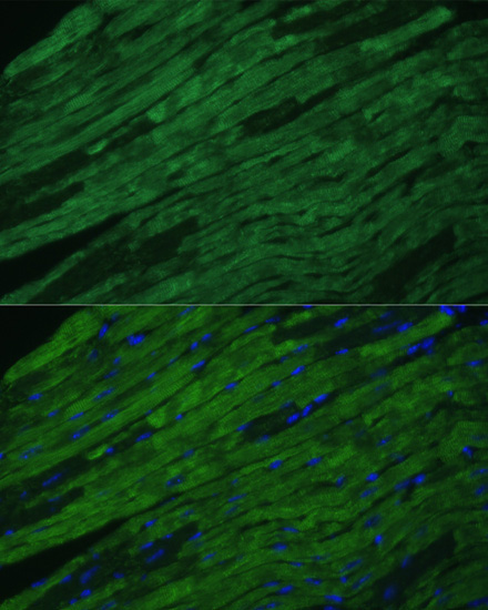 Cardiac Troponin I (TNNI3) Rabbit Polyclonal Antibody - Image 3