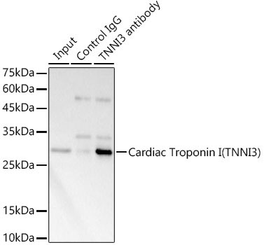 Cardiac Troponin I (TNNI3) Rabbit Polyclonal Antibody - Image 4