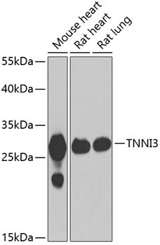 Cardiac Troponin I (TNNI3) Rabbit Polyclonal Antibody