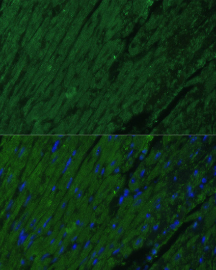 Cardiac Troponin I (TNNI3) Rabbit Polyclonal Antibody - Image 2