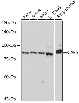 CARS Rabbit Monoclonal Antibody