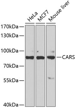 CARS Rabbit Polyclonal Antibody