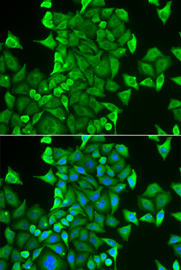 CARS Rabbit Polyclonal Antibody - Image 2