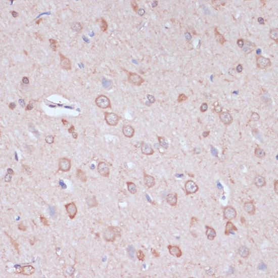 CARTPT Rabbit Polyclonal Antibody