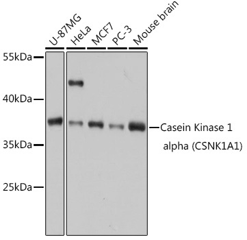 Casein Kinase 1 alpha (CSNK1A1) Rabbit Polyclonal Antibody