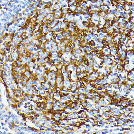 Casein Kinase 1 alpha (CSNK1A1) Rabbit Polyclonal Antibody - Image 2