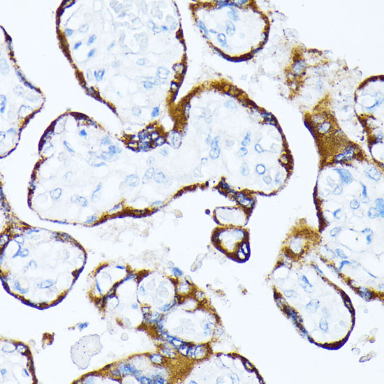 Casein Kinase 1 alpha (CSNK1A1) Rabbit Polyclonal Antibody - Image 3