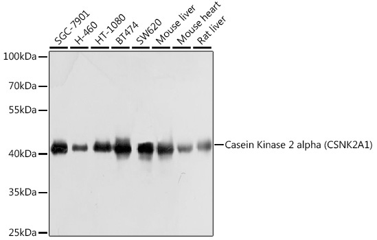 Casein Kinase 2 alpha (CSNK2A1) Rabbit Polyclonal Antibody