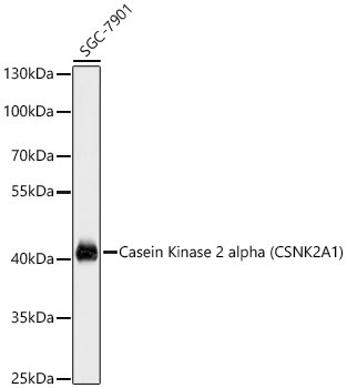 Casein Kinase 2 alpha (CSNK2A1) Rabbit Polyclonal Antibody - Image 3