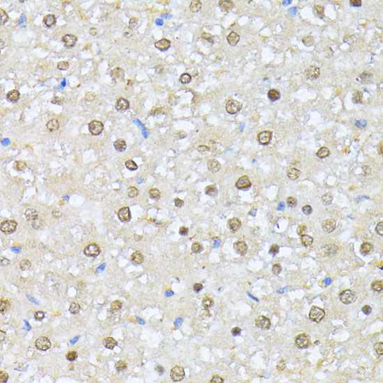 Casein Kinase 2 alpha (CSNK2A1) Rabbit Polyclonal Antibody - Image 4