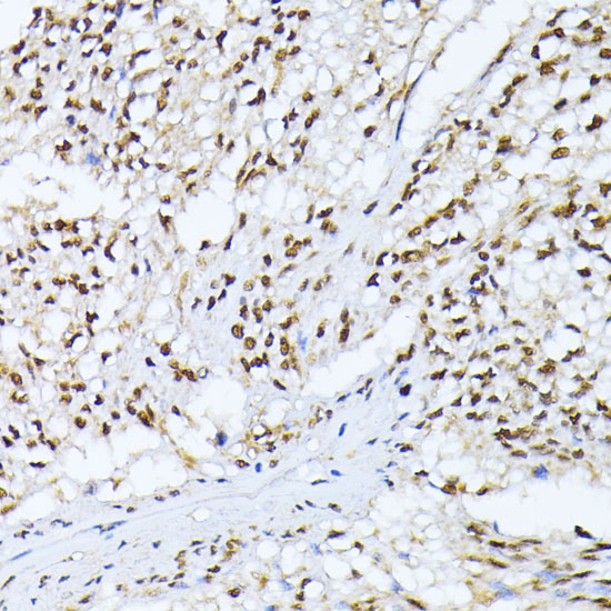 Casein Kinase 2 alpha (CSNK2A1) Rabbit Polyclonal Antibody - Image 5