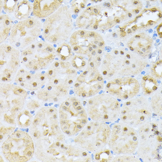 Casein Kinase 2 alpha (CSNK2A1) Rabbit Polyclonal Antibody - Image 6