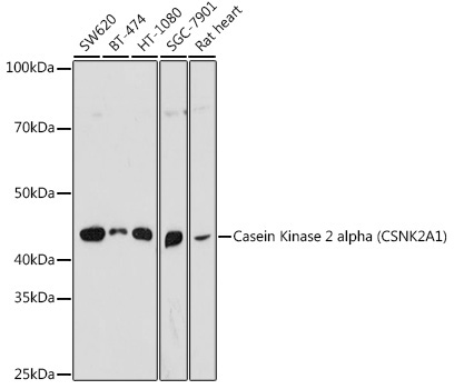 Casein Kinase 2 alpha (CSNK2A1) Rabbit Polyclonal Antibody