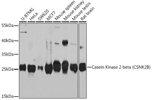 Casein Kinase 2 beta (CSNK2B) Rabbit Polyclonal Antibody