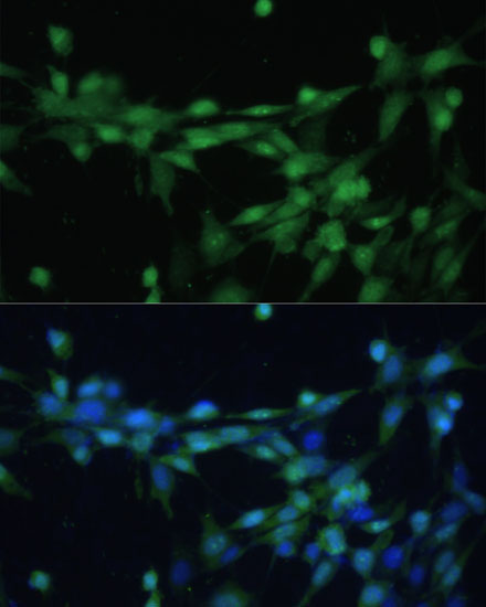 Casein Kinase 2 beta (CSNK2B) Rabbit Polyclonal Antibody - Image 2