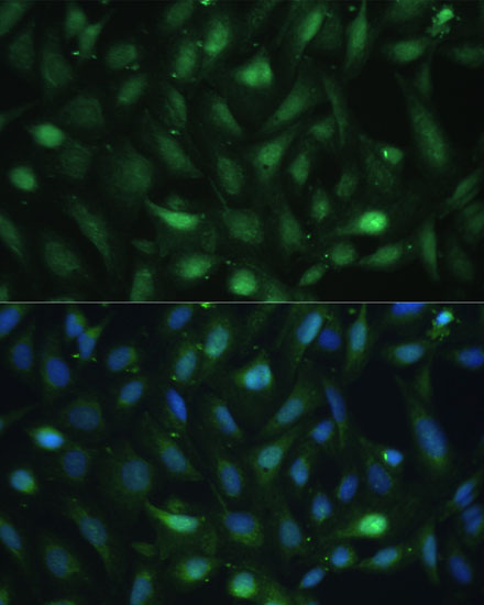 Casein Kinase 2 beta (CSNK2B) Rabbit Polyclonal Antibody - Image 3