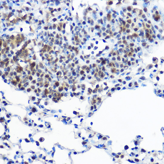 Casein Kinase 2 beta (CSNK2B) Rabbit Polyclonal Antibody - Image 2