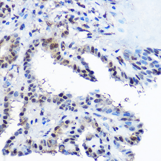 Casein Kinase 2 beta (CSNK2B) Rabbit Polyclonal Antibody - Image 3