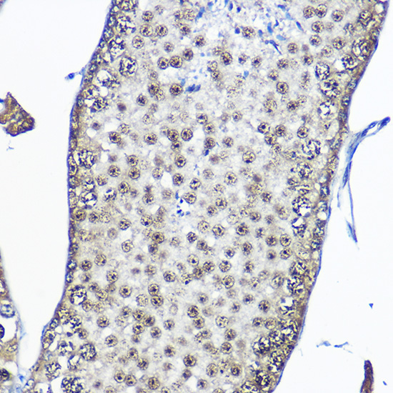 Casein Kinase 2 beta (CSNK2B) Rabbit Polyclonal Antibody - Image 4
