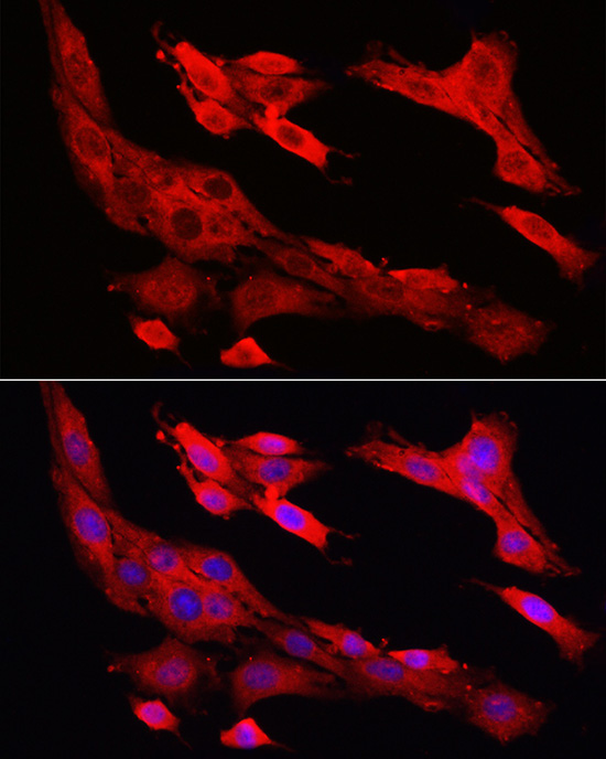 Caspase-1 Rabbit Polyclonal Antibody - Image 5
