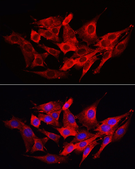 Caspase-1 Rabbit Polyclonal Antibody - Image 6
