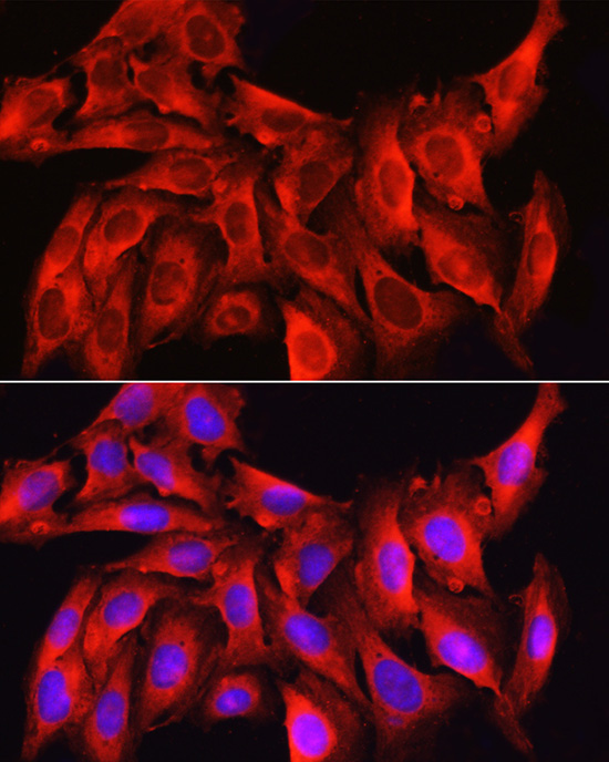 Caspase-1 Rabbit Polyclonal Antibody - Image 7