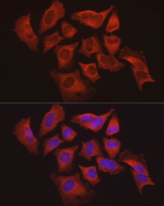 Caspase-1 Rabbit Polyclonal Antibody - Image 3