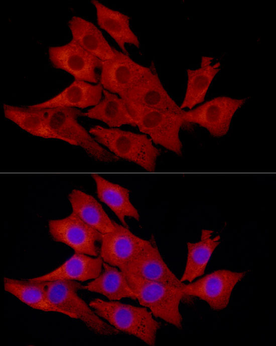 Caspase-1 Rabbit Polyclonal Antibody - Image 4