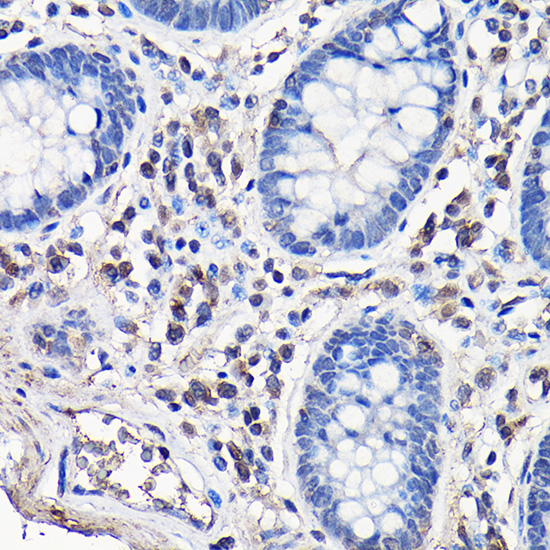 Caspase-8 Rabbit Polyclonal Antibody - Image 2