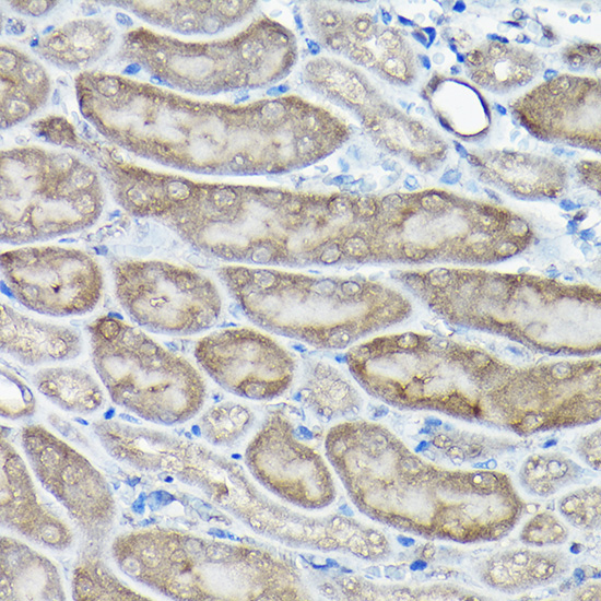 Caspase-8 Rabbit Polyclonal Antibody - Image 3