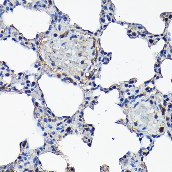 Caspase-8 Rabbit Polyclonal Antibody - Image 4
