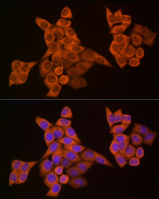 Caspase-8 Rabbit Polyclonal Antibody - Image 5