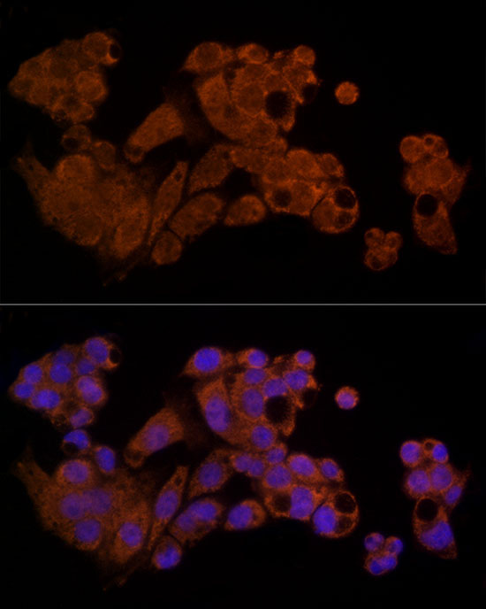 Caspase-8 Rabbit Polyclonal Antibody - Image 6