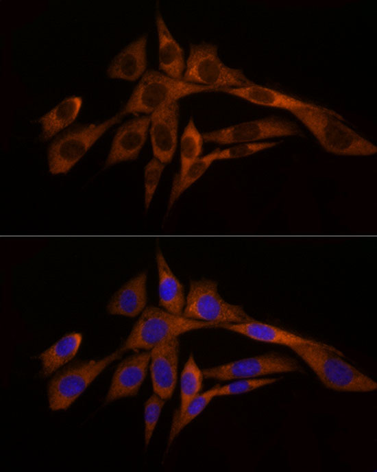 Caspase-8 Rabbit Polyclonal Antibody - Image 7