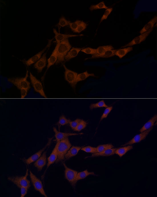 Caspase-8 Rabbit Polyclonal Antibody - Image 8