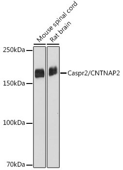 Caspr2/CNTNAP2 Rabbit Monoclonal Antibody