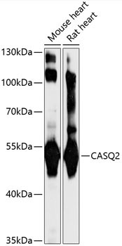 CASQ2 Rabbit Polyclonal Antibody