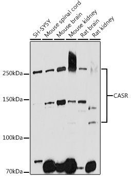CASR Rabbit Polyclonal Antibody