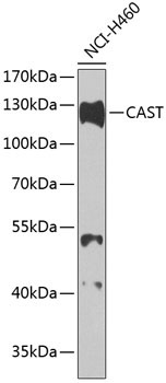 CAST Rabbit Polyclonal Antibody
